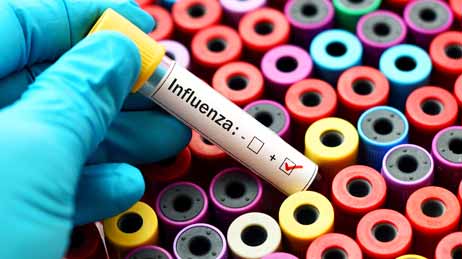 Stages of Influenza Virus